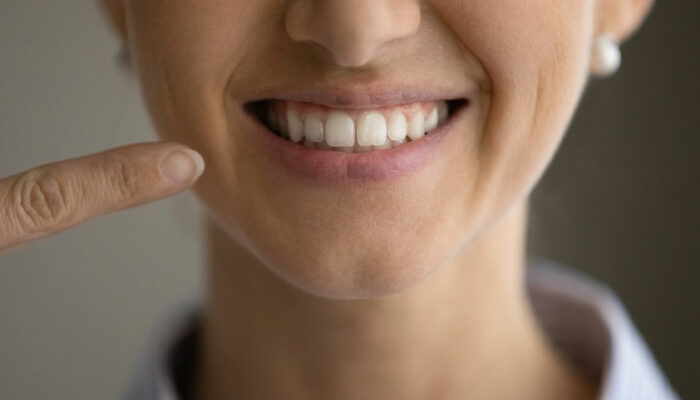 Easy remedies to whiten teeth at home