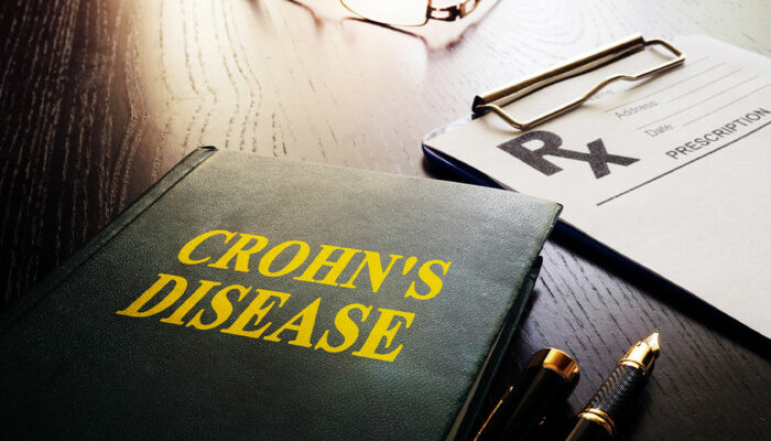 Warning signs of Crohn’s disease