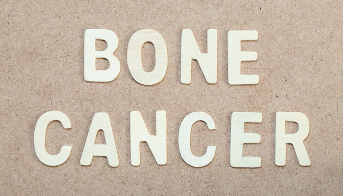 Common types of bone cancer and their symptoms