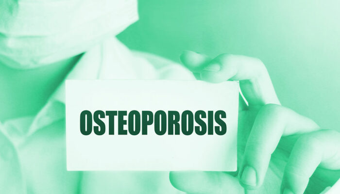 Signs, causes, and risk factors of osteoporosis