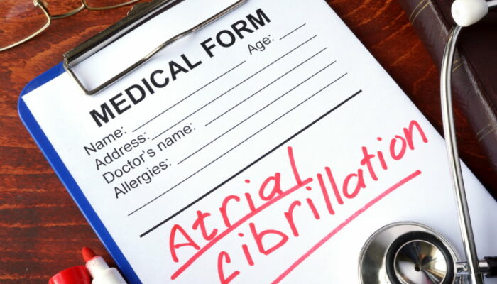 8 warning signs of atrial fibrillation