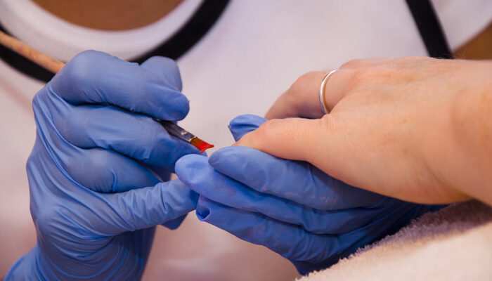 Nail fungal infection – Causes, symptoms, and management