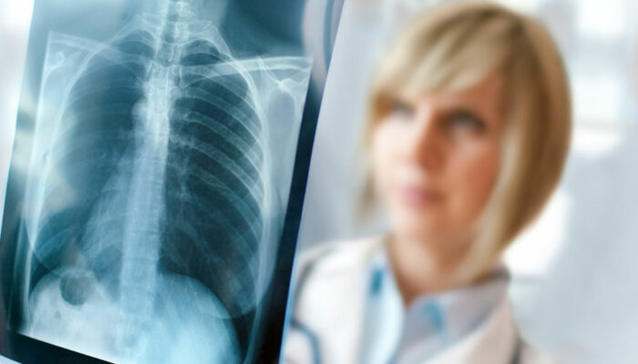 Signs and symptoms that may indicate lung diseases